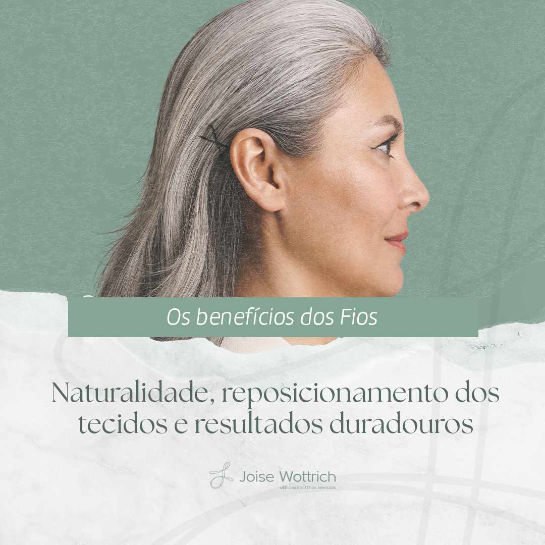 Porque os fios se tornaram um dos procedimentos mais desejados da estética moderna