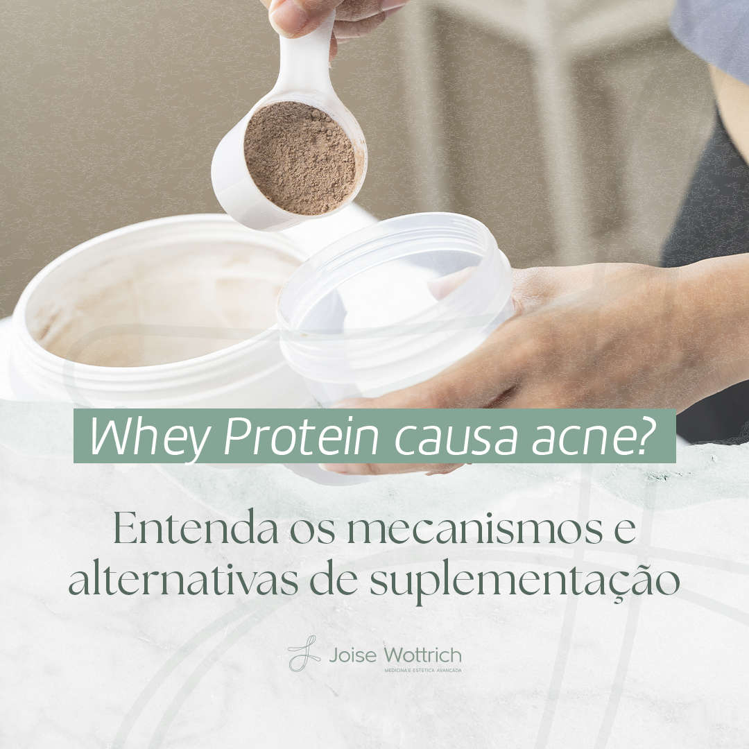 Whey Protein causa acne?